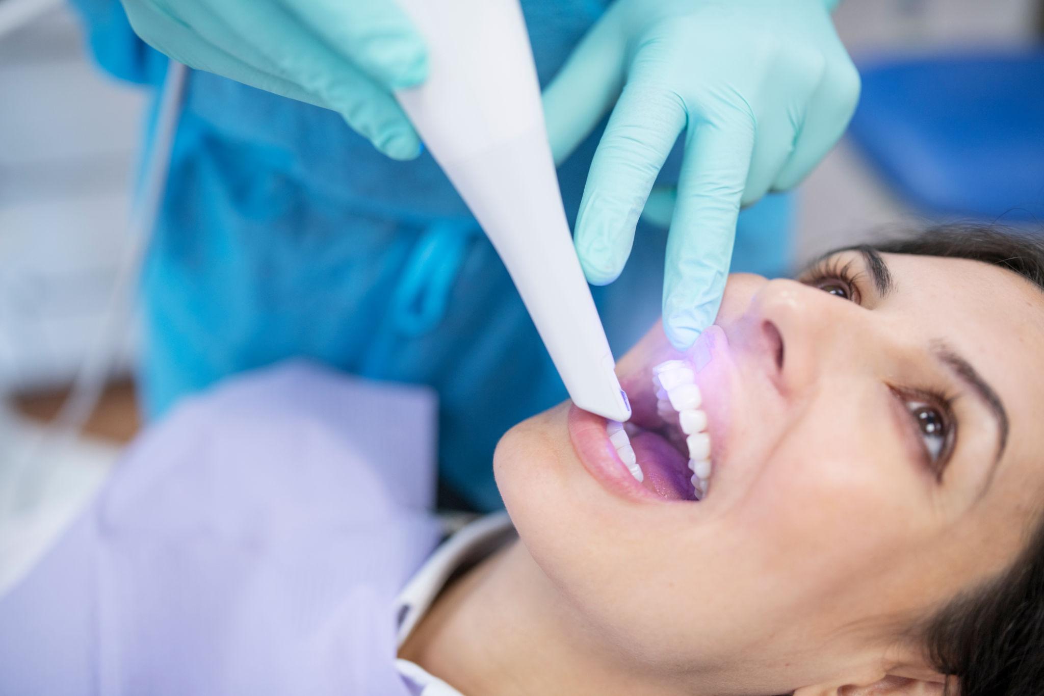 3D Dental Scanner